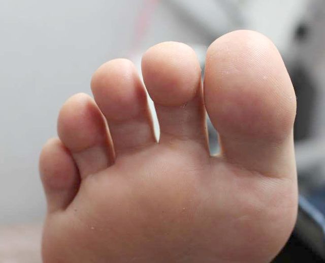 25세 여성 · 10개월 경과